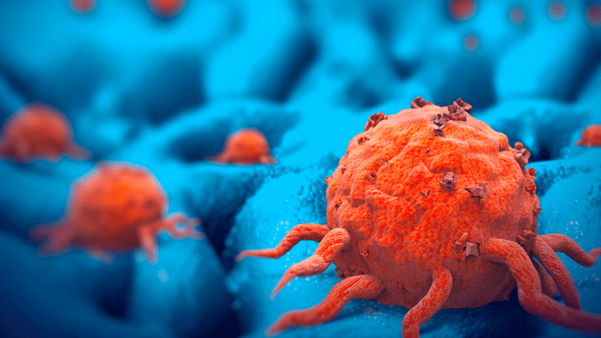 CBD For Cancer Pain