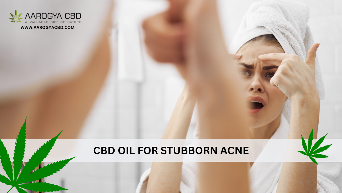 CBD Oil for Stubborn Acne: Know how it is a boon