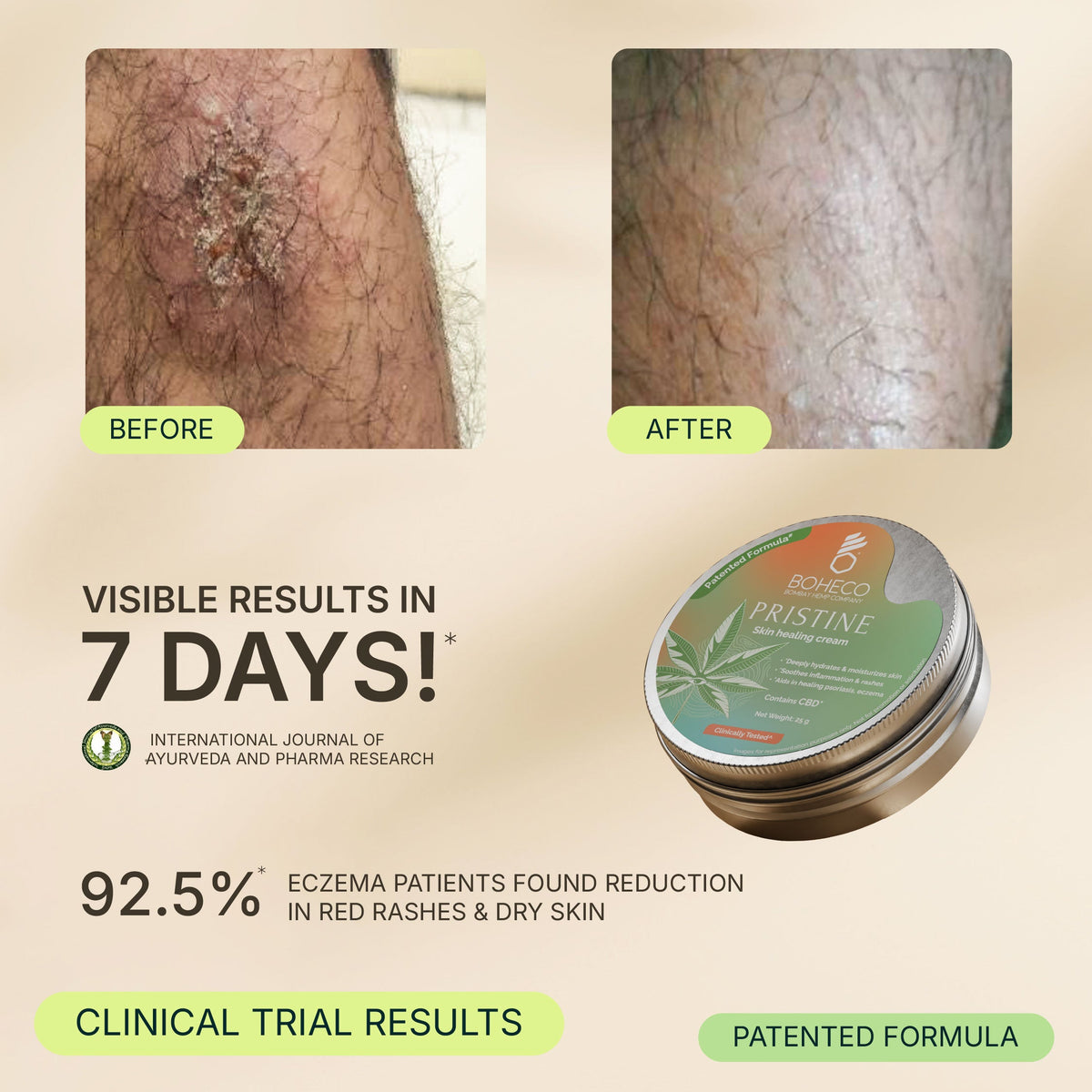 Boheco Pristine Skin Healing Cream 25gm